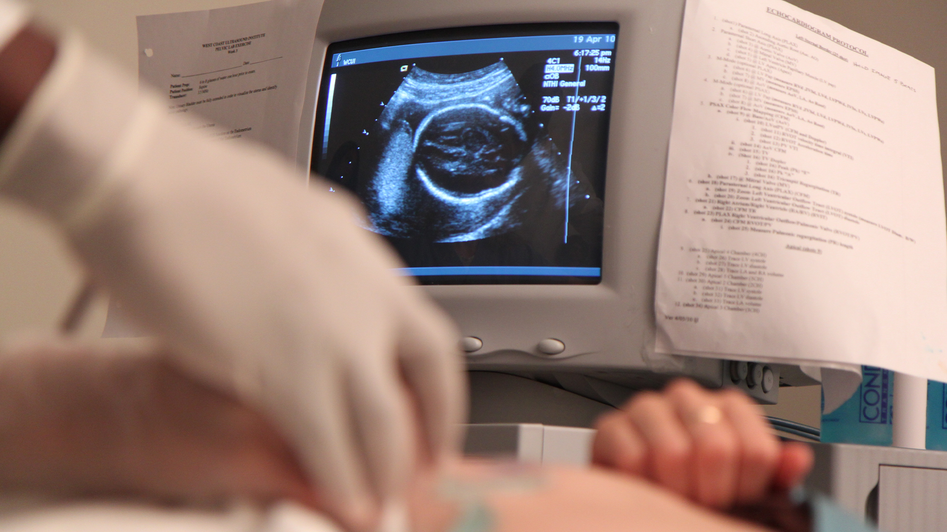 7 ways to serve your local pregnancy resource center